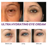 Zenbora Xylane Eye Cream, Pro-Xilane Active Anti-Wrinkle Eye Cream, Anti-Aging Active Eye Repair/Lifting Cream for Anti-Oxidation, Fade Fine Lines, Dark Circles, Puffiness around Eyes-0.53 OZ/15 G