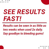 Perio Care Gel for Trays (1 Tube) - 1.7% Hydrogen Peroxide Gel - Compare to Perio Gel, Perio Gel X, Perio Protect Gel, GumX Defender Plus Gel, Perio Daily Defense Gel & Perio Restore Gel