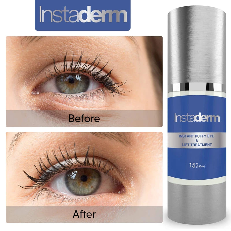 Instant Puffy Eye & Lift Treatment – Removes Under Eye Bags & Puffiness. Eliminate Dark Circles & Wrinkles. Naturally Ageless Hydrating Cream. Disappears Before Your Eyes Within Minutes.
