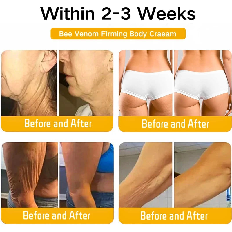 Bee Lift Anti Aging Firming Body Cream, Bee Venom Wrinkle Removal Cream, Collagen Firming Body Lotion, Neck Firming Cream For Loose Skin, Skin Tightening Cream Body, Restore Elasticity, Hydration