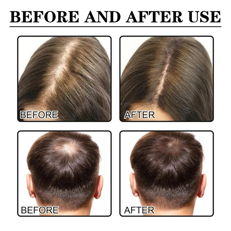 2 Pcs Hair Growth Serum,Hair Enhancing Serum, Strengthens Hair Repair Root Thickening Hairline Nourishing Hair Essence