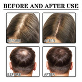 2 Pcs Hair Growth Serum,Hair Enhancing Serum, Strengthens Hair Repair Root Thickening Hairline Nourishing Hair Essence