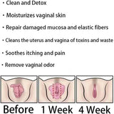 AnnieCare Instant Anti-Itch Detox Products, Annie Care Capsulas, Firming Repair & Pink and Tender Natural Capsules, Annie Care Capsulas (8Bag)