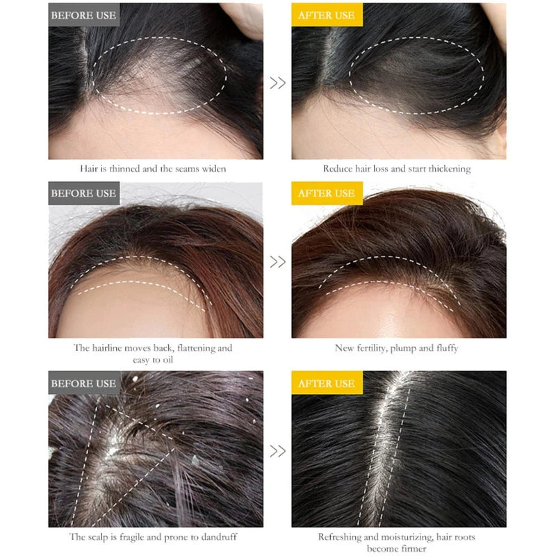 Lidoria Ginger Anti Hair Loss 7 Days, Ginger Essential Oil for Hair Growth Stronger and Fuller Hair, Hair Growth Serum for women for Dry Damaged Hair, Thicker Longer Hair (1.2 Oz(Pack of 2))