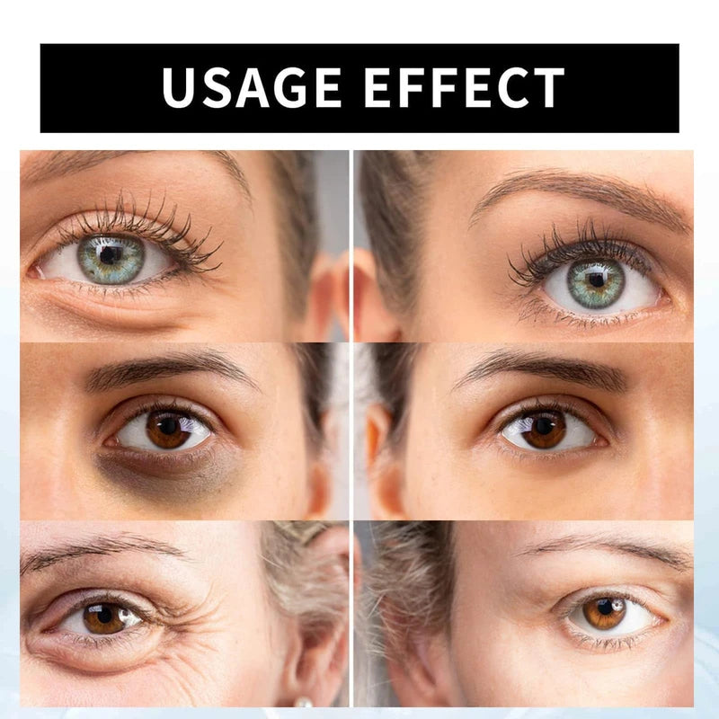 Celyn Instant Firm Eye Tightener, Ksndurn Eye Bag Cream - Reduce Eye Bags, Fade Fine Lines, Dark Circles, Tightens & Smoothes Fine Lines (2Pcs x 30ml)