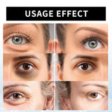 Celyn Instant Firm Eye Tightener, Ksndurn Eye Bag Cream - Reduce Eye Bags, Fade Fine Lines, Dark Circles, Tightens & Smoothes Fine Lines (2Pcs x 30ml)