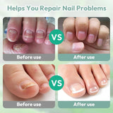 Nail Care Pen, Pack of 3 Nail Fungus Pen, Nail Care Pen, Health Routin Nail Care Pen, Nail Care Pen with Tea Tree Oil, Aloe Vera & Vitamin E, for Nourished Fingernails & Toenails