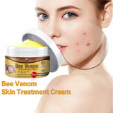 flysmus Bee Venom Comprehensive cream,flysmus Bee Venom Cream, Visibly reduces skin blemishes and smoothes skin (3)