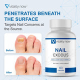 Vitality Now Nail Exodus - Vitality Healthy Nails - Premium Formula for Healthier Feet - 60 Capsules