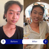 iBlush Asian Flush Patches - 36 Discreet, All Natural Patches Powered By Vitamins & Minerals - Fast, Effective & Backed By Science