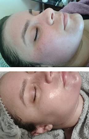 Herbal Power Peel- Chemical & Acid Free Green Herbal Deep Sea Peel-Professional or Home Use