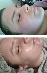 Herbal Power Peel- Chemical & Acid Free Green Herbal Deep Sea Peel-Professional or Home Use