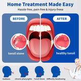 Tonsil Stone Remover Kit with Camera, Visual Tonsil Stone Removal Tool with LED Light, Rechargeable Tonsillolith Removal Tool with 4 Head - Fight Bad Breath - Attachments for iOS & Android(Black)