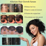 FIONEL Allurium Hair Growth Serum Designed for Black Women with Herbs and Natural Vitamin (4 Pack)