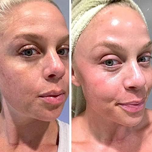 Retinol Gel 0.1 Vitamin A Repairs Fine Lines & Wrinkles, Scar Treatment, Age and Sun Spots, Anti-Aging Formula Gel 20 Grams