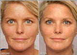Retinol Gel 0.1 Vitamin A Repairs Fine Lines & Wrinkles, Scar Treatment, Age and Sun Spots, Anti-Aging Formula, 20 Grams