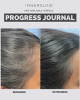 Inner Glow Advanced Hair, Skin & Nails Formula - Dermatologist and Plastic Surgeon Developed, clinically Tested for visibly Stronger and Thicker Hair in 12 Weeks