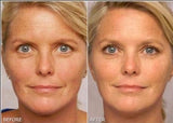 Retinol Gel 0.1 Vitamin A Repairs Fine Lines & Wrinkles, Scar Treatment, Age and Sun Spots, Anti-Aging Formula Gel 20 Grams