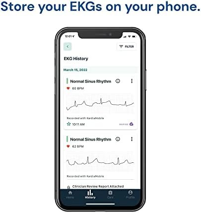 KardiaMobile 1-Lead Personal EKG Monitor – Record at Home – Detects AFib & Irregular Arrhythmias – Easy Results in 30 Seconds – Works w/Most Smartphones - FSA/HSA Eligible