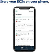 KardiaMobile 1-Lead Personal EKG Monitor – Record at Home – Detects AFib & Irregular Arrhythmias – Easy Results in 30 Seconds – Works w/Most Smartphones - FSA/HSA Eligible