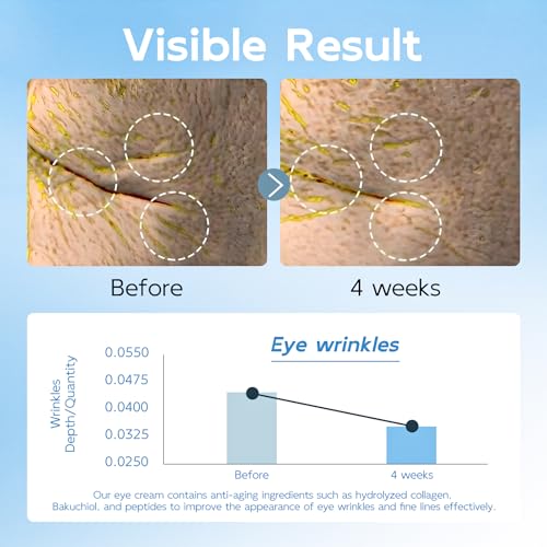 Tantea Under Eye Cream Anti-Aging | 6 in 1 Collagen Anti-Wrinkle Eye Cream - Peptides, Bakuchiol, Centella - Wrinkles | Fine Lines | Dark Circles | Puffiness | Natural Retinol Alternative, 0.68 fl.Oz