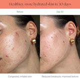 Canopy Filtered Shower Head - High Pressure Shower Head Filter for Hard Water - Shower Filter To Remove Impurities for Healthier Scalp, Skin & Hair - Support Hair Growth & Minimize Breakage - Chrome