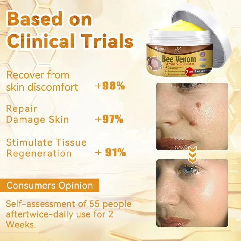 flysmus Bee Venom Comprehensive cream,flysmus Bee Venom Cream, Visibly reduces skin blemishes and smoothes skin (3)