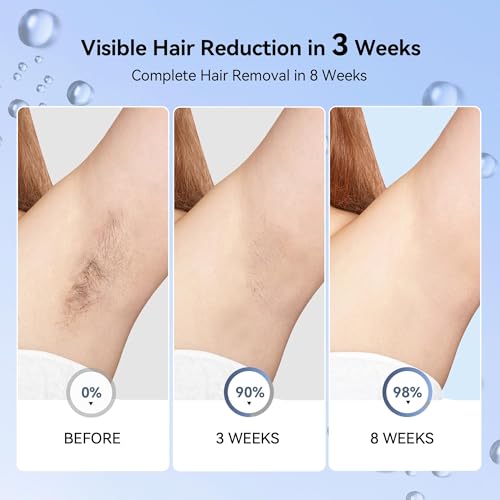Laser Hair Removal for Women, IPL Laser Hair Removal Device, Painless Hair Remover at Home with Sapphire Ice-Cooling, Long-Lasting Hair Reduction in 3 Weeks for Face Body Bikini, Gifts for Women Her