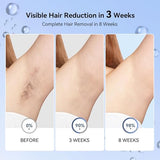 Laser Hair Removal for Women, IPL Laser Hair Removal Device, Painless Hair Remover at Home with Sapphire Ice-Cooling, Long-Lasting Hair Reduction in 3 Weeks for Face Body Bikini, Gifts for Women Her
