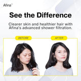 Afina Filtered Shower Head, Filter for Hard Water | Improves Skin & Hair by Reducing Chlorine & Heavy Metals from Hard Water | High Pressure Shower Filter Head for Hard Water (Black)