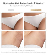 INIA Laser Hair Removal with Ice-Cooling Care for Women and Men, Painless at-Home IPL Hair Remover for Coarse Hair in Bikini and All Body Areas, Latest Generation for Effective Results (Hot Pink)