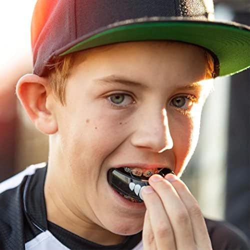 Shock Doctor Orthodontic Mouth Guard for Braces for Sports, Hockey, Lacrosse, Football, Baseball, Braces Mouth Guard, Upper Teeth Protection, Adult & Youth Mouth Guard Sizes, Blue