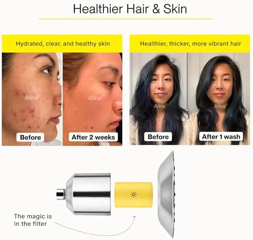 Afina Filtered Shower Head | High Pressure Shower - Reduces Dry Itchy Skin, Dandruff, Eczema, & Dramatically Improves Condition of your Skin, Hair & Nails (Nickel)