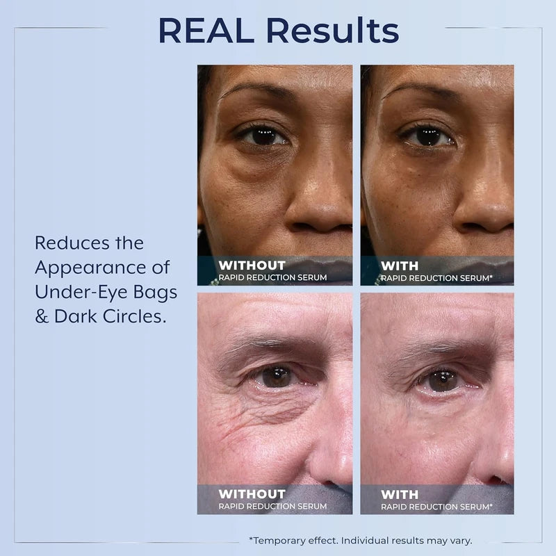 Plexaderm Rapid Reduction Eye Serum - Advanced Formula Anti Aging Visibly Reduces Under-Eye Bags, Wrinkles, Dark Circles, Fine Lines & Crow's Feet Instantly Instant Wrinkle Remover for Face