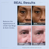 Plexaderm Rapid Reduction Eye Serum - Advanced Formula Anti Aging Visibly Reduces Under-Eye Bags, Wrinkles, Dark Circles, Fine Lines & Crow's Feet Instantly Instant Wrinkle Remover for Face