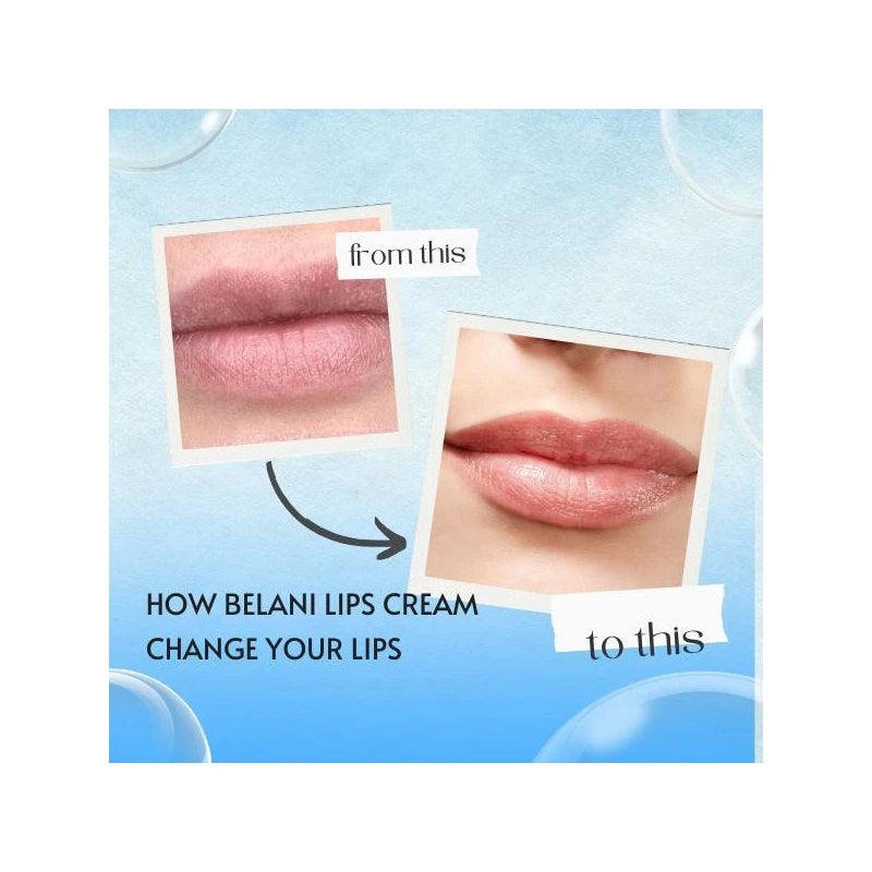 Belani Fordyce Lip Acne Cream - Smooth Lip Corrector for Fordyce Spots & Acne - Color: Combo 3 Boxes