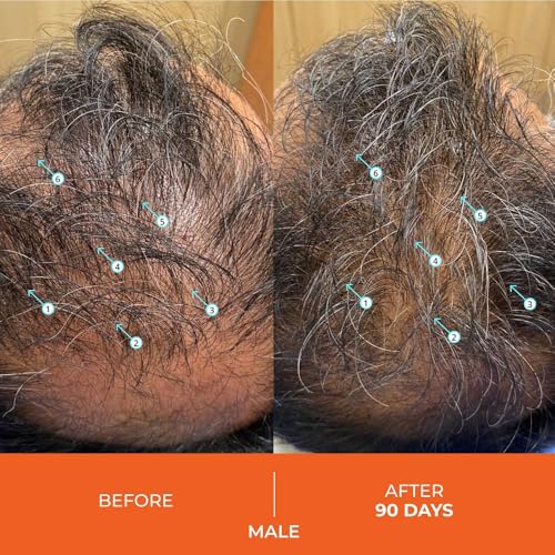 DS Labs Revita Conditioner – High-Performance Hair Density Conditioner, Strengthening, Thickening & Volumizing, Fuller, Healthier-Looking Hair, Sulfate & Silicone Free, For Men & Women, 500mL, Packaging May Vary