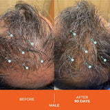 DS Labs Revita Conditioner – High-Performance Hair Density Conditioner, Strengthening, Thickening & Volumizing, Fuller, Healthier-Looking Hair, Sulfate & Silicone Free, For Men & Women, 500mL, Packaging May Vary