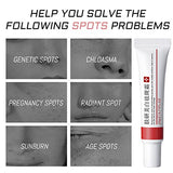 2 Pcs Whitening Freckle Cream, Acne Scar Removal Treatment Cream, Pigmentation Removal Cream for Face, Moisturizing Removes Facial Melasma Dark Spots Wrinkles Blemishes (whitening freckle cream)