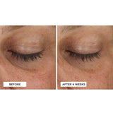 Cold Plasma Plus+ Advanced Eye Cream, 0.5 fl. oz.