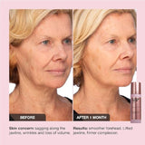 iNNBEAUTY PROJECT Extreme Cream Anti-Aging, Firming, & Lifting Refillable Moisturizer (1.7 oz / 50 mL)