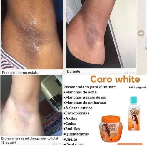 Caro White Set-3 (Lotion 10.14oz + Cream 10.14oz + Soap 6.3oz)