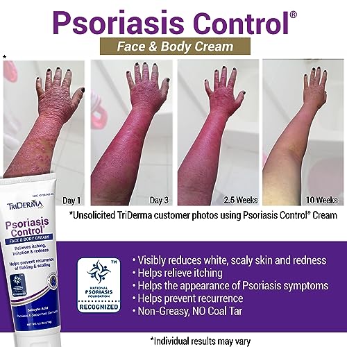 TriDerma Psoriasis Control Face and Body Cream, 4.2 Ounces, 4 Pack