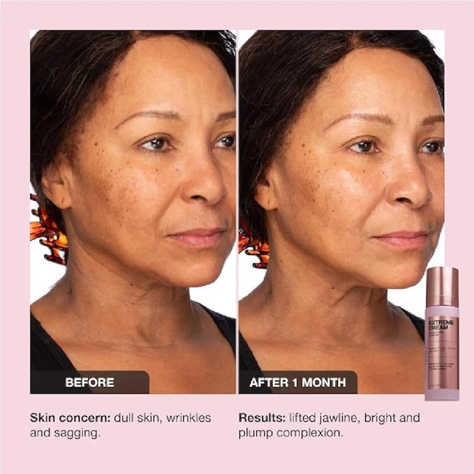 iNNBEAUTY PROJECT Extreme Cream Anti-Aging, Firming, & Lifting Refillable Moisturizer (1.7 oz / 50 mL)