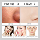 2Pcs Black and White Rice Exfoliant, Rice Ampoule Duo White Rice Ampoule Black Rice Exfoliating Peeling Solution, Moisturizing & Pore Minimizer for Face (Black & White Rice Exfoliant)