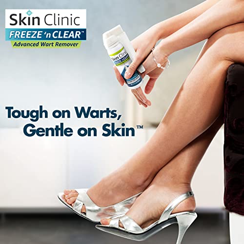 Skin Clinic FREEZE 'n CLEAR™ Advanced Wart Remover, Tough on Warts, Gentle on Skin, (12 Precision Applicators)