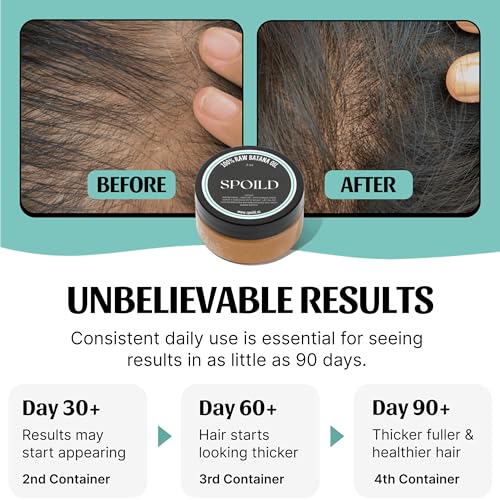 Raw Batana Oil for Hair Growth and Health - Sourced from Honduras, Dr. Sebi 100% Natural Remedy, Prevents Hair Loss, Promotes Thicker, Stronger, Healthier Hair with Shine Treatment, 2oz