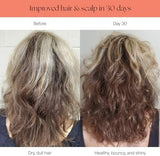 Canopy Filtered Shower Head - High Pressure Shower Head Filter for Hard Water - Shower Filter To Remove Impurities for Healthier Scalp, Skin & Hair - Reduce Dry Skin & Breakage - Black Shower Head