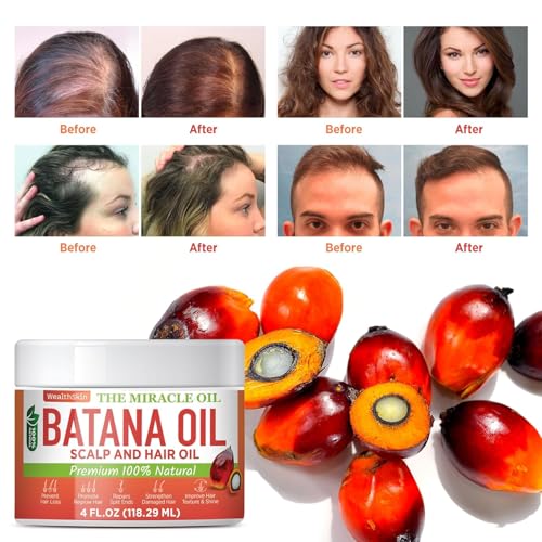 Batana Oil for Hair Growth: 100% Pure & Organic Raw Botana Oil from Honduras – Natural Hair & Scalp Care for Thicker, Stronger Hair – Best for Men & Women - 4 FL OZ