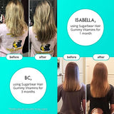 Sugarbear Hair Vitamins Extra Strength Biotin 6000mcg, Vitamin C, E, Coconut Oil, Zinc, Folic Acid, Inositol - Vegan Gummies for Luscious Hair and Nails - Supplement for Women & Men (1 Month Supply)